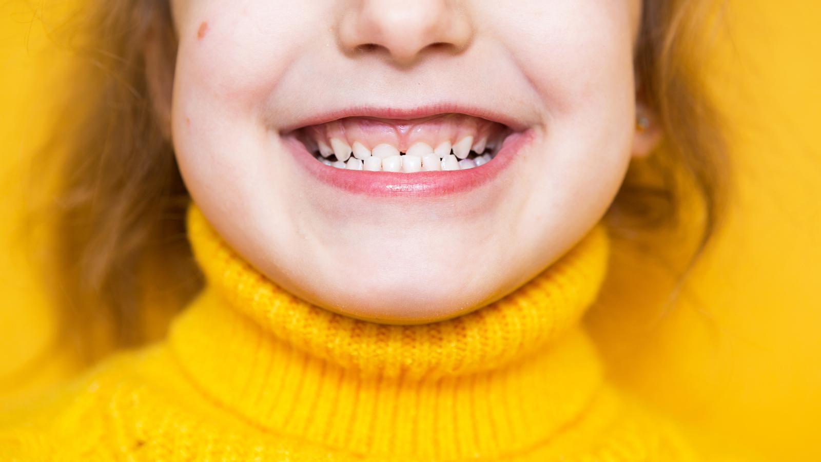 Close-up of a child smiling with visible overbite, wearing a bright yellow sweater.