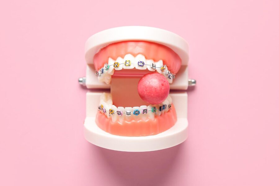 a prop mouth with braces with a ball of gum.
