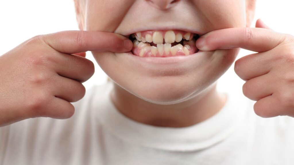 child showing his teeth.
