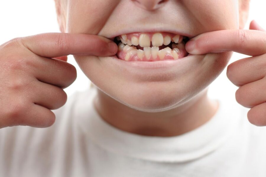 child showing his teeth.